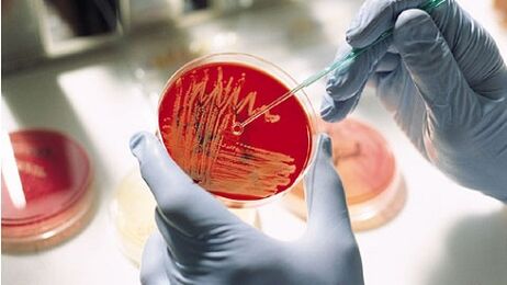 baktēriju kultūra prostatīta ārstēšanai, lai izrakstītu antibiotikas