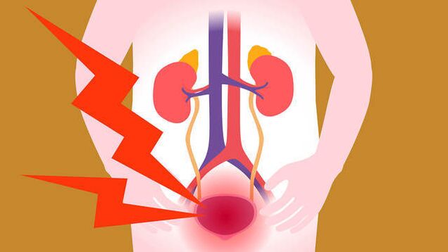 sāpes urīnpūšļa zonā ar akūtu prostatītu
